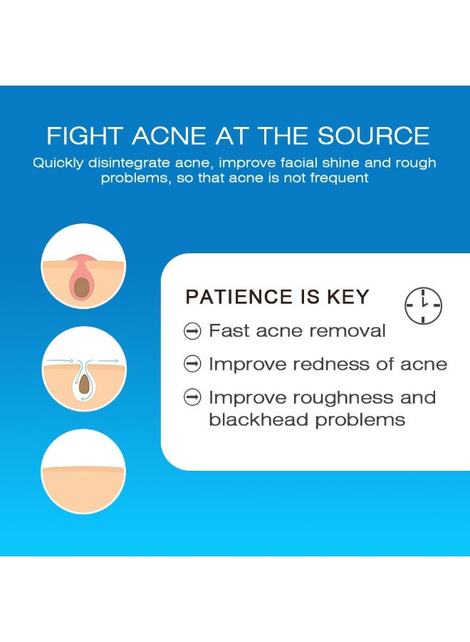 Sumifun 4% Acne Scar Fading Cream - 4% Complex Fading Factor, Suitable for All Skin Types, Reduces Acne Scars and Pits, Deeply Penetrates, 20g - Image 4